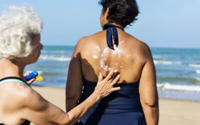 A woman applies sunscreen to another woman's back at the beach, to help prevent Melanoma